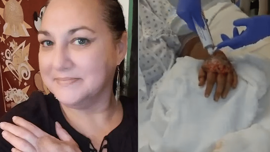 Heather Harbotlle, recuperada, e em imagem de vídeo feita quando ela estava no hospital se recuperando da infecção - Arquivo Pessoal/Reprodução MDW Features