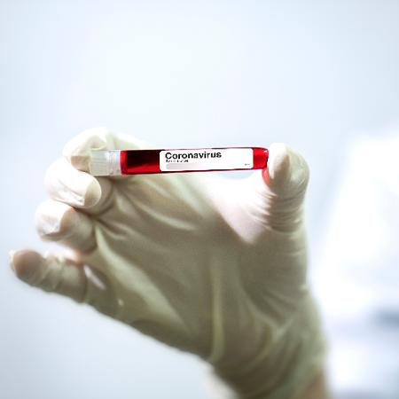 Teste de sorologia detectou anticorpos contra covid-19 - Getty Images/EyeEm