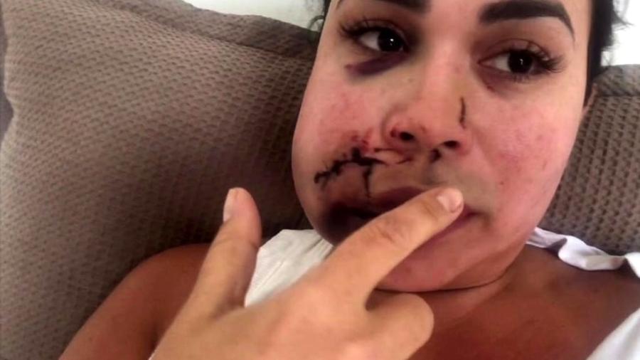 A corretora de imóveis Milka Borges da Silva, 33, agredida em restaurante do no Jockey Clube de SP - Reprodução