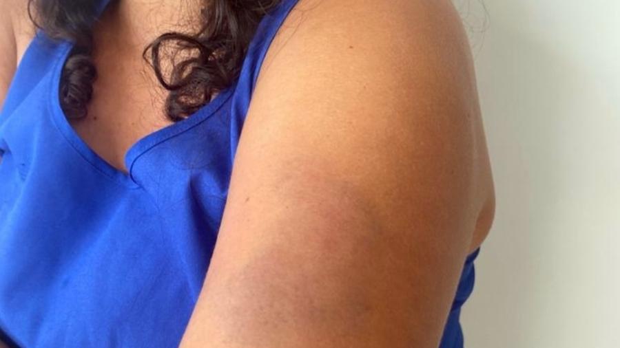 Jacqueline Debora Costa de Oliveira, de 42 anos, disse que foi atacada após ser confundida com ladra - Arquivo Pessoal