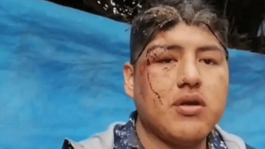 Ainda com sangue e marcas de violência no rosto, rapaz foi até delegacia, mas polícia se recusou a registrar ocorrência - Reprodução/Youtube/P7