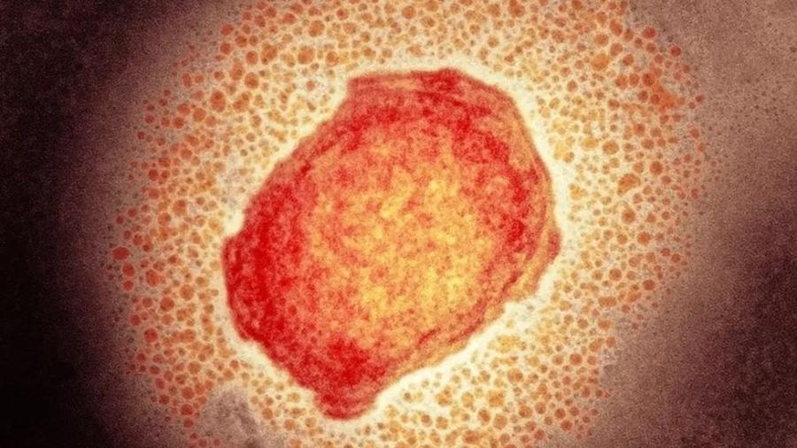 Partícula do vírus da varíola do macaco - SCIENCE PHOTO LIBRARY