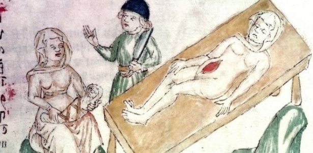 Na era medieval, os médicos já entendiam que o problema afetava tanto mulheres quanto homens - Welcome Images
