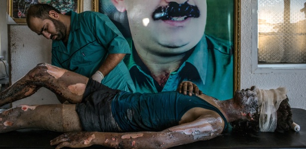 Doutor curdo trata as queimaduras de um combatente do Estado Islâmico em Hasaka, na Turquia - Maurício Lima/NYT