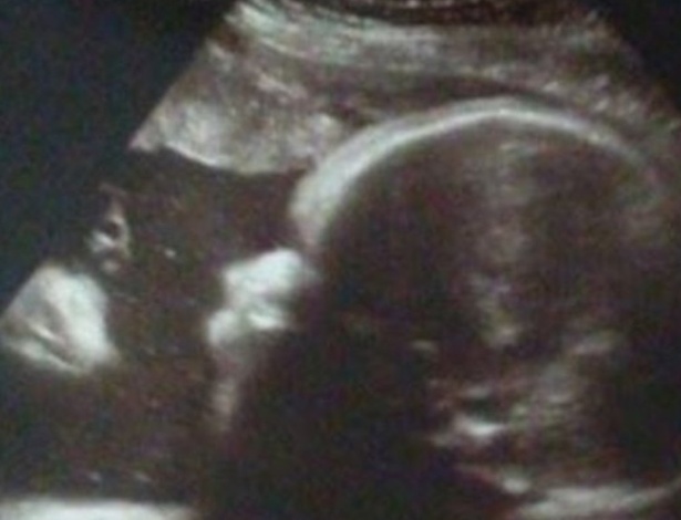 Pais se surpreenderam após exame de ultrassom da filha: viram imagem de Jesus - Reprodução/Facebook
