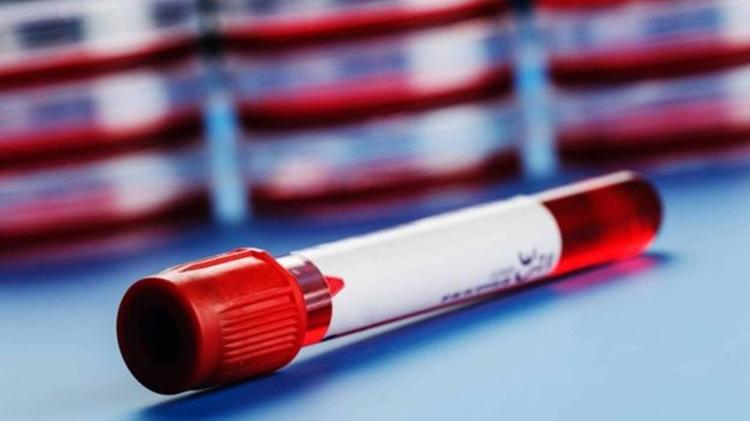 Apesar de casos isolados de possível reinfecção estarem pipocando pelo mundo, não há evidências científicas de que essa seja uma possibilidade - Getty Images - Getty Images
