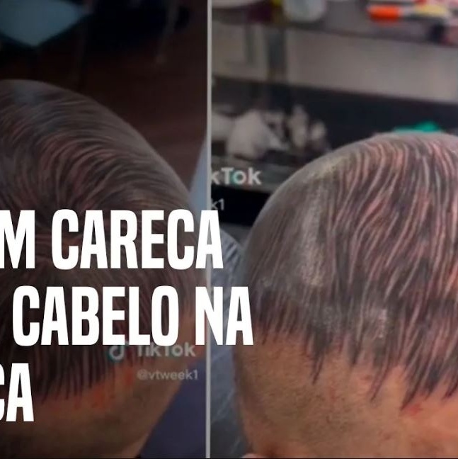 Homem calvo faz tatuagem no lugar do cabelo e viraliza na web: 'Lindo  demais