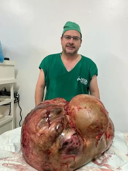 O médico cirurgião Glaucio Boechat disse que esse foi o maior tumor que ele já operou em 20 anos de profissão - Arquivo Pessoal - Arquivo Pessoal