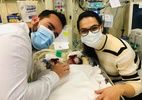 Gêmeas siamesas são separadas em hospital de SP; pai celebra 