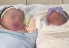 Mulher dá à luz gêmeas sem saber de gravidez e uma das bebês cai na privada - Reprodução