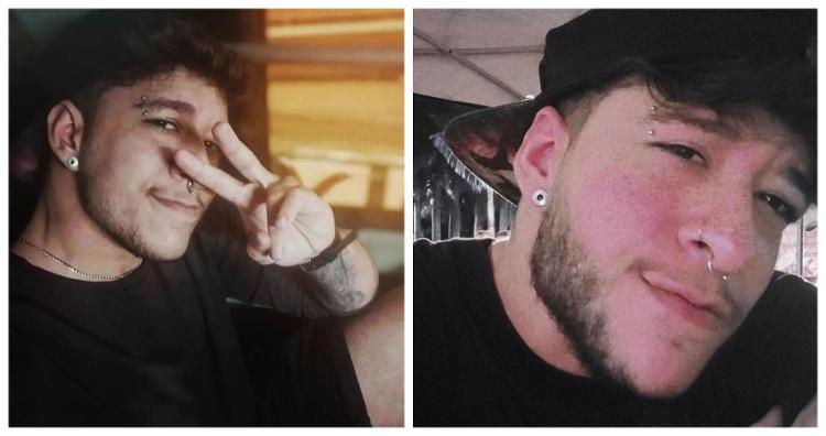 O antes e depois da harmonização facial de Kaique de Castro de Lucena, 29