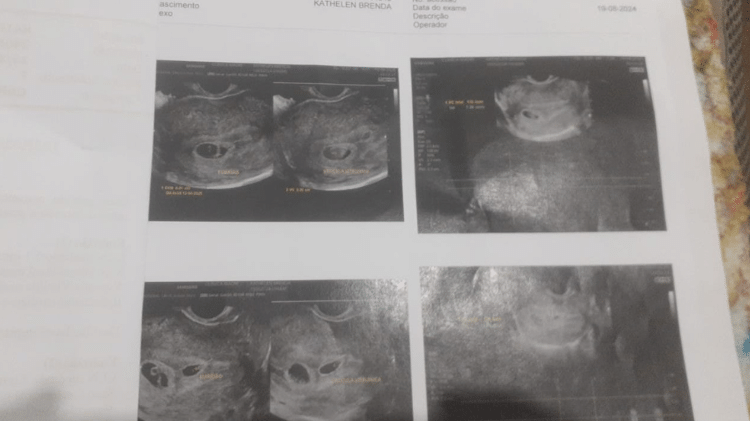 Imagens referentes ao ultrassom feito em clínica particular em agosto do ano passado Imagens referentes ao ultrassom feito em clínica particular em agosto do ano passado