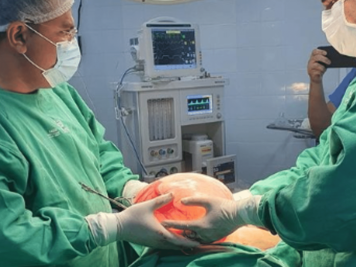 A maior remoção de cisto de ovário já registrado aconteceu no México