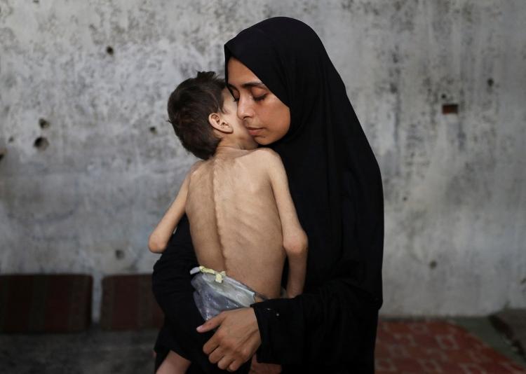 ministerio-da-saude-da-palestina-afirma-que-122-pessoas-morreram-de-fome-em-gaza-83-delas-eram-criancas-1753453935504_v2_750x1 Gaza tem cinco mortos por fome em 24 h; ONU vê ajuda ineficiente de Israel…