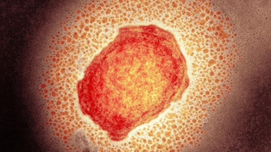 Partícula do vírus da varíola dos macacos; doença geralmente começa com sintomas semelhantes aos da gripe - Science Photo Library