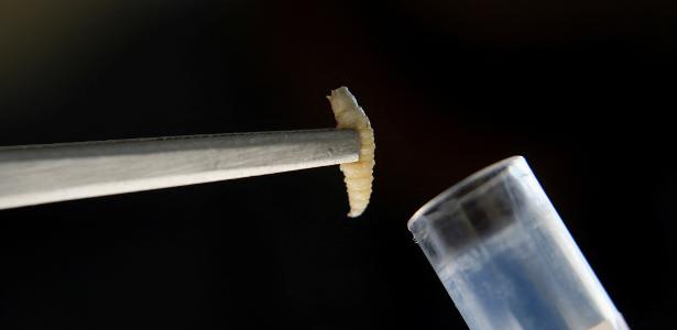 Cover image for Larva de mosca parasita é encontrada perto da fronteira dos EUA e gera alerta