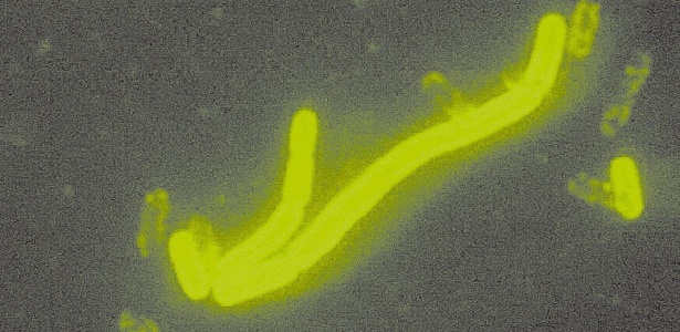 A bactéria Yersinia Pestis, que ainda mata milhares em países pobres - CDC/Divulgação