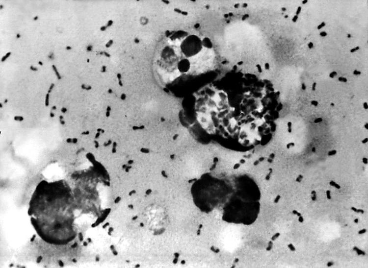 Yersinia Pestis, a bactéria da peste bubônica