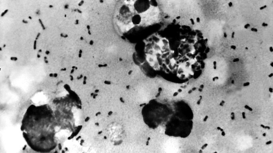 Yersinia Pestis, a bactéria da peste bubônica - Getty Images
