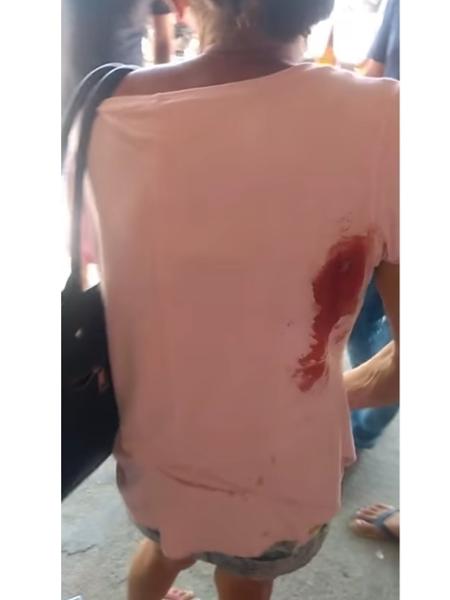Mulher é atingida por tiro em São Gonçalo - Reprodução/Facebook