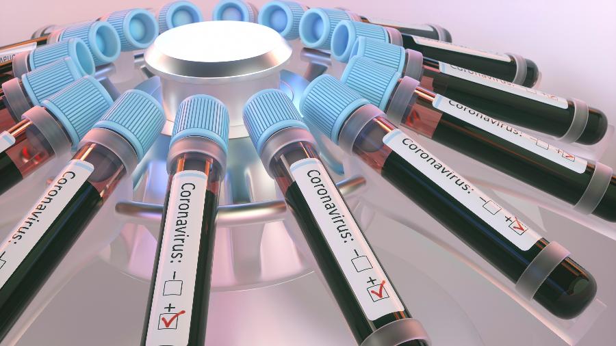 Testes do novo coronavírus - Getty Images