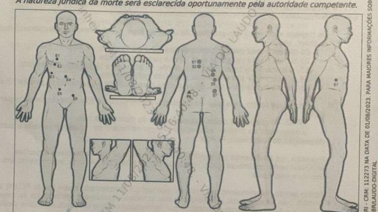 Reprodução do laudo necroscópico de Felipe Vieira Nunes, que mostram entradas e saídas dos disparos