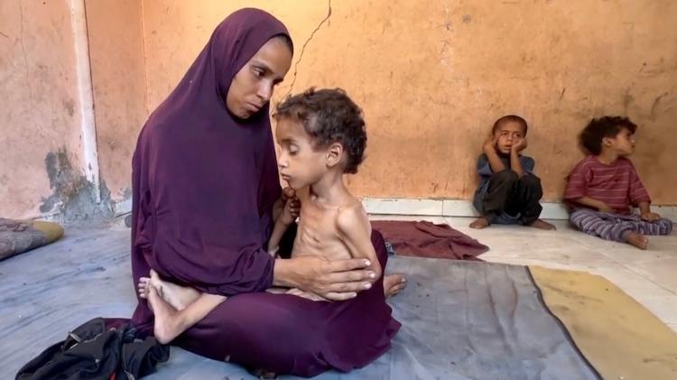 Criança de dois anos desnutrida e sua mãe em um campo de refugiados no Norte de Gaza 