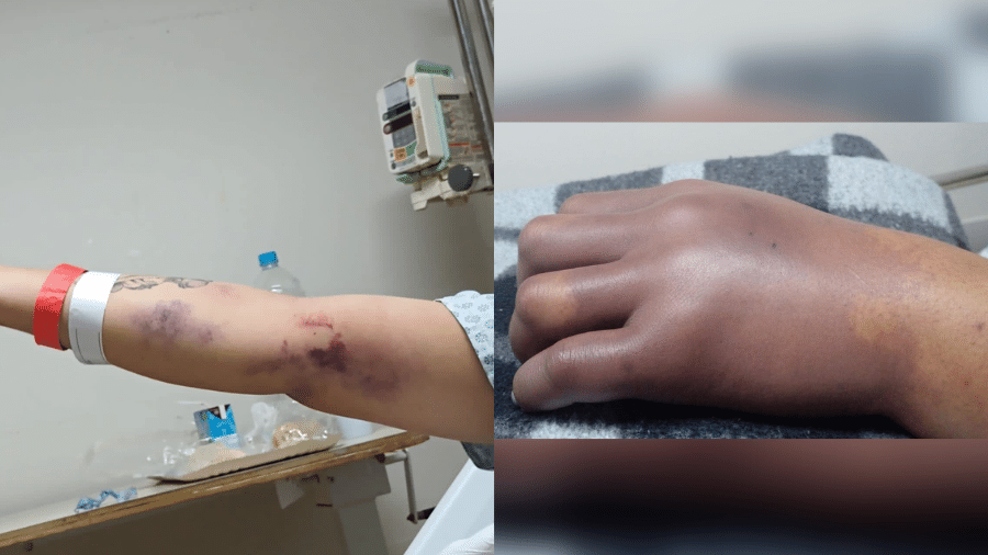 Gleice Kelly Gomes, de 24 anos, se internou em um hospital particular no Rio de Janeiro para dar à luz, mas teve o braço esquerdo amputado - Arquivo pessoal