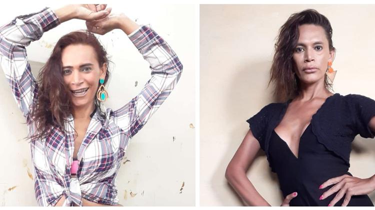 O antes e depois da harmonização facial de Robertta de Freitas Lima, 44