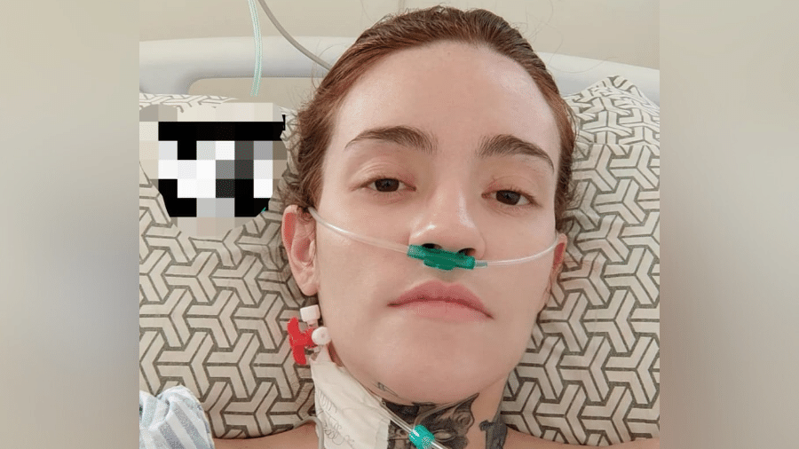 Carolina Arruda, 27, sofre de neuralgia do trigêmeo e sente a 'pior dor do mundo' desde os 16 anos