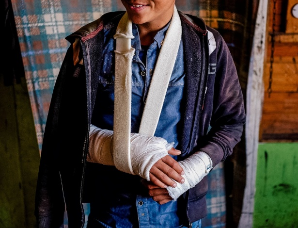 20.abr.2017 - Um jovem migrante paquistanês caiu dos muros de segurança que cercam o porto e quebrou o braço enquanto tentava fugir da polícia portuária em Patras, na Grécia - Fahrinisa Oswald/Slate