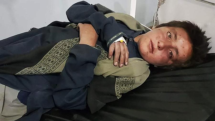 Um menino ferido recebe tratamento em um hospital após ataques aéreos do Paquistão, em Khost, em 16 de abril de 2022 - -/AFP