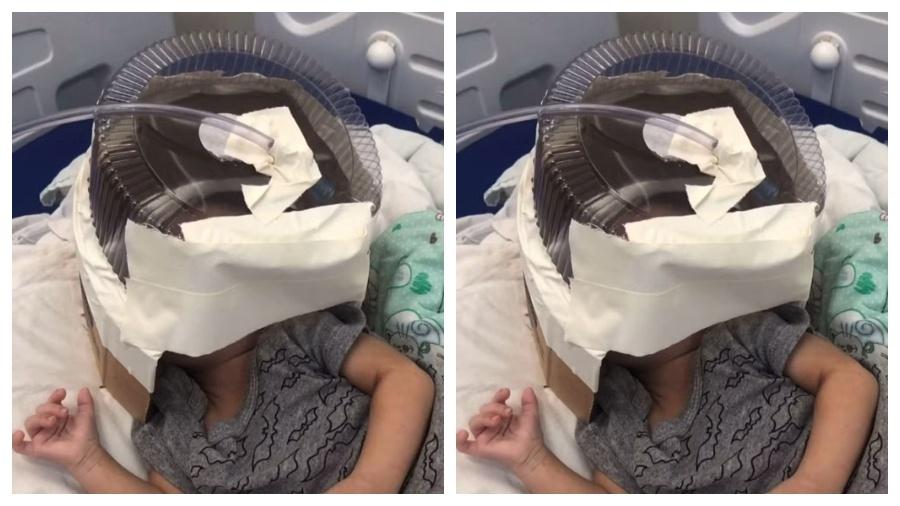 Hospital usou embalagem de bolo como máscara de oxigênio para a criança