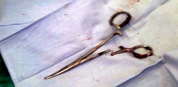 "Tesoura" que foi retirada do abdômen do paciente - Vietnam News Agency via AFP