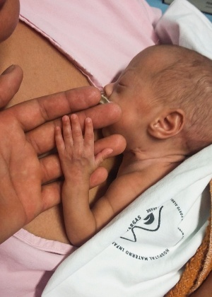 Vitória nasceu com 380 gramas e após 117 dias internada, vai ter alta, já com 2,18 kg, em Porto Alegre (RS) - Divulgação PMPA