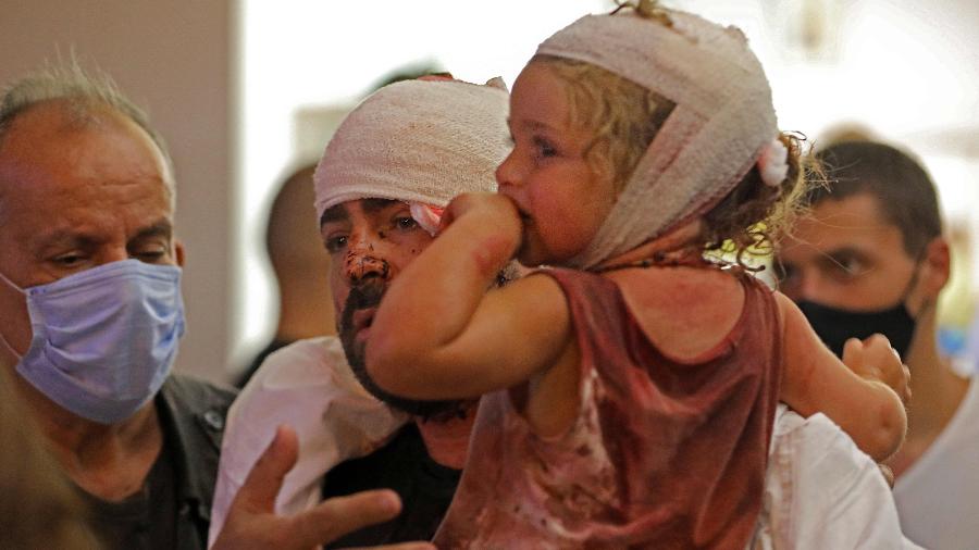 Criança ferida após explosão na região portuária de Beirute, em hospital na capital do Líbano - IBRAHIM AMRO/AFP