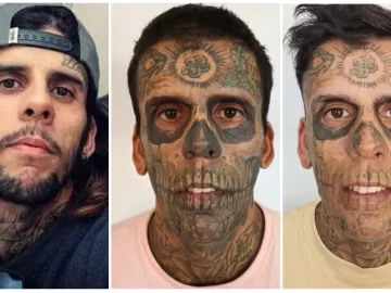 Agora evangélico, 'homem mais tatuado do Brasil' começa a remover tatuagens