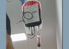 Paciente vai para UTI após suspeita de transfusão de sangue errado no PR