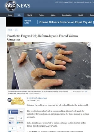 Uma prótese de dedo custa cerca de R$ 6.400 - Reprodução/ABC News
