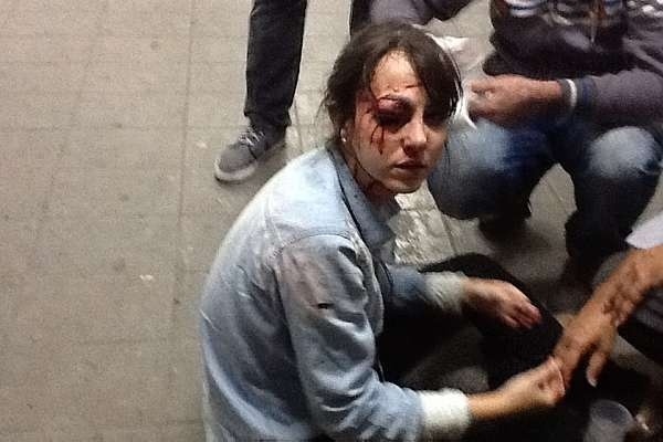 13.jun.2013 - Repórter do jornal Folha de S. Paulo foi atingida no olho por uma bala de borracha durante protesto contra aumento da tarifa do transporte coletivo em São Paulo