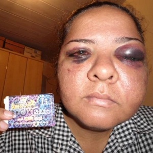 Fabiana diz que foi agredida por policiais ao tentar entrar na Festa do Peão de Americana (SP) - Reprodução/Facebook