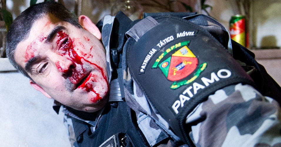 27.jun.2013 - Sargento é ferido no olho durante manifestação em Porto Alegre, na noite de quinta-feira (27). Ele foi atingido por uma pedra no rosto, depois de tentar socorrer uma manifestante que ficou isolada na área do conflito