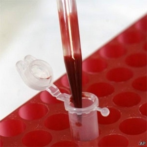 No futuro, exame de sangue poderá prever envelhecimento - AP via BBC