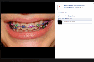 Colorir O Aparelho Com Itens Comprados Na Web E Perigoso Alertam Dentistas 17 07 2013 Uol Noticias