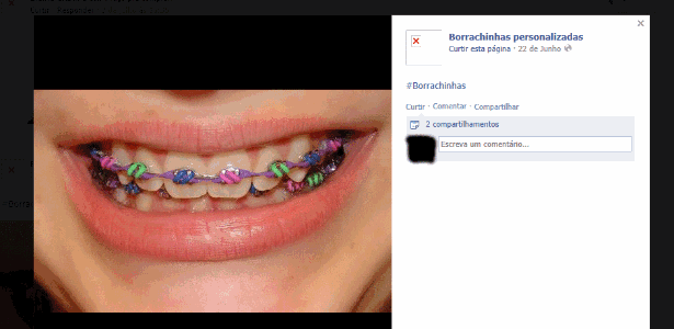 Reprodução da página do Facebook que comercializa os produtos ortodônticos como a borracha colorida - Reprodução