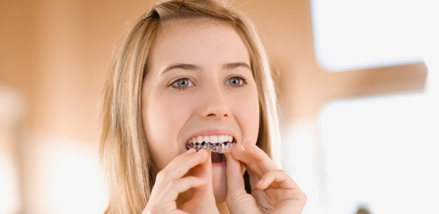 O uso de gel clareador sem acompanhamento pode causar hipersensibilidade e manchas nos dentes - Thinkstock