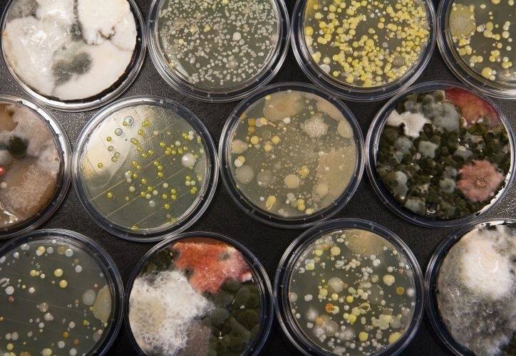 Você sabia que cada 6,4 cm² de pele do corpo humano tem cerca de 32 milhões de bactérias? Na foto, placas revelam a concentração de bactérias - Rafael Hupsel/Folhapress