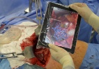 Cirurgia feita com tablet usa realidade aumentada para reconstruir órgão - Fabian Bimmer /Reuters