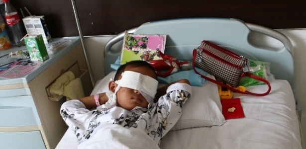 Um menino de seis foi internado em um hospital após ter seus globos oculares arrancados