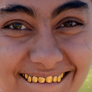 9.set.2013 - Cigana de uma comunidade na aldeia de Pidvynogradiv, na Ucrânia, exibe os dentes de ouro, tradição em sua etnia - Yuri Dyachyshyn/AFP